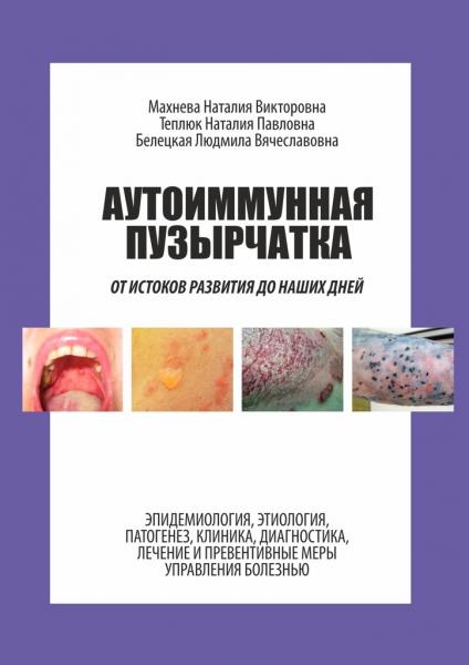 Н.В. Махнева. Аутоиммунная пузырчатка. От истоков развития до наших дней