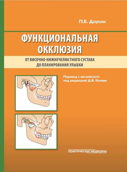 П.Е. Доусон. Функциональная окклюзия: от височно-нижнечелюстного сустава до планирования улыбки