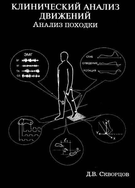 Д.В. Скворцов. Клинический анализ движений. Анализ походки